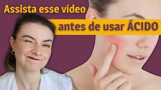 O perigo de usar ácidos na sua skincare  Dica de Esteticista [upl. by Karwan]