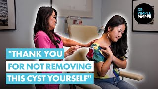 quotThank You for Not Removing this Cyst Yourselfquot Dr Lee Meets J Before Her Cyst Procedure [upl. by Ecirtap]