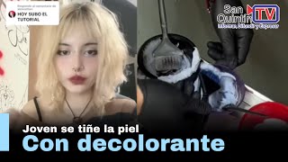 Mujer se aclara la piel con decolorante para cabello y lo comparte en redes [upl. by Roselane]