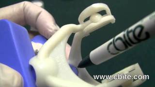 Dental Articulators Viper  Proper Glue Application [upl. by Gambrill625]