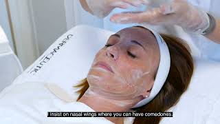 Dermaceutic Milk Peel performed by Dr Catherine Saubiez acne mildacne [upl. by Mady]