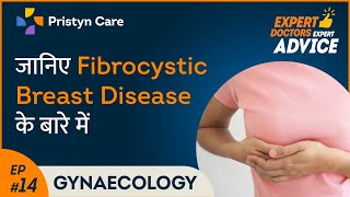 Fibrocystic Breast Disease in Hindi [upl. by Enitsenre]