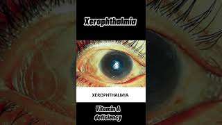 Xerophthalmia nightblindness xeropthalmia in animals animals veterinary vitamin A deficiency [upl. by Larson]