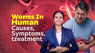 Worms In Human  Causes Symptoms treatment  Healthy Life Style  Worm Diseases [upl. by Ahsinit13]