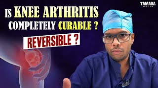 Knee pains amp Arthritis  Reversibiity of Rheumatoid arthritis and Osteoarthritis  In English [upl. by Nosa175]