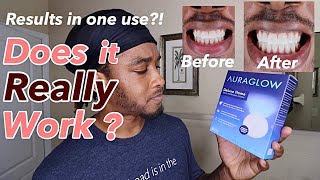 AURAGLOW Whitening Kit  Does it REALLY Work  LED Light  AuraGlow teethwhitening [upl. by Yrkcaz]