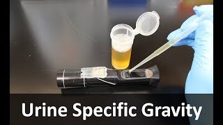 Urine Specific Gravity Refractometer [upl. by Horbal220]