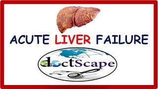 ACUTE LIVER FAILURE by DoctScape [upl. by Haeluj]