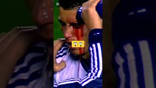 Sports Industries Injured Moments Photos 😱😰😭 ronaldo cristiano photoshoot injury football cr7 [upl. by Donni]