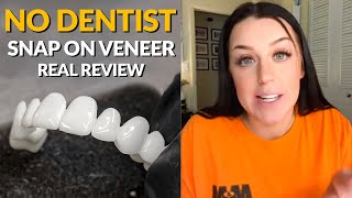 Snap On Removable Dental Veneers Review  The Best Alternative to 20000 Cosmetic Dentistry [upl. by Farrison]