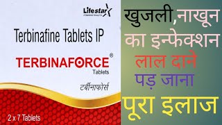 Terbinaforce 250mg Tablet viralvideo medical [upl. by Eelyram382]