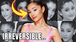 What quotHAPPENEDquot to Ariana Grandes EYES  Plastic Surgery Analysis [upl. by Irahs]