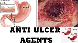 Anti Ulcer AgentsPPIH2 RECEPTOR ANTAGONISAMHARIC TUTORIAL [upl. by Elbertina]