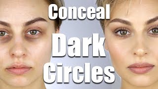 How To Conceal Dark Circles Under Eyes  Alexandra Anele [upl. by Berlyn]