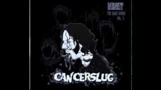 Cancerslug  Heartless [upl. by Haven153]