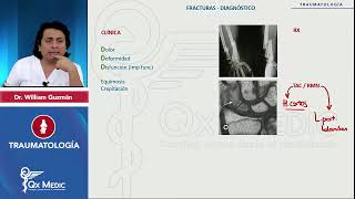 ENAM QxMedic TRAUMATOLOGÍA Fracturas generalidades Diagnóstico [upl. by Rigdon]