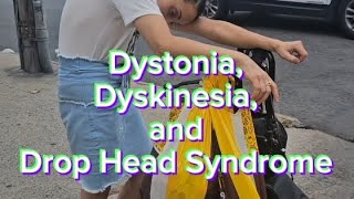 Dystonia Dyskinesia and Drop Head Syndrome [upl. by Doggett]