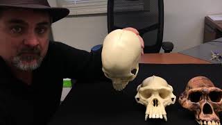 Anatomy of the Foramen Magnum Explained skull skulls skeletalsystem [upl. by Acimat268]