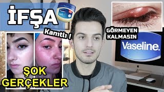 VAZELİN İFŞA   Kanıtlarıyla  │ Cilt Bakımı [upl. by Asher]