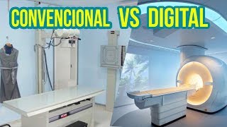 RADIOLOGIA CONVENCIONAL VS DIGITAL [upl. by Barnet916]