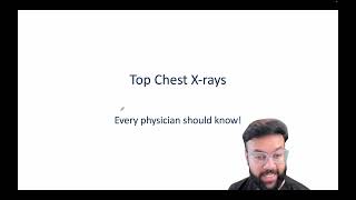 Top 8 Essential Chest XRay Findings Every Physician Should Know  Radiology Basics  USMLEStrike [upl. by Chantal]