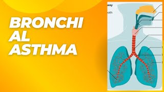 TOPIC15quotBRONCHIAL ASTHMA ITS SYMPTOMS DIAGNOSIS AND TREATMENT [upl. by Devora]