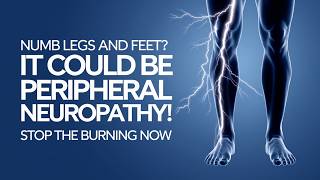 NUMB legs and feet It Could Be Peripheral Neuropathy Stop the Burning Now [upl. by Eniowtna]