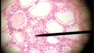 Slide 05  Thyroid Gland Follicles  Simple Cuboidal [upl. by Ylrebmit993]