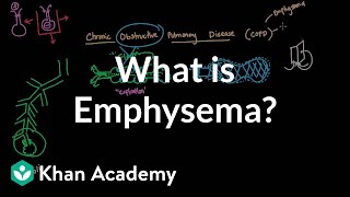 What is emphysema  Respiratory system diseases  NCLEXRN  Khan Academy [upl. by Christean132]