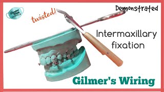 GILMERS WIRING  INTERMAXILLARY FIXATION [upl. by Nordgren]