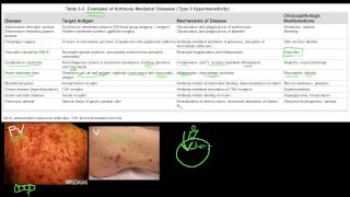 78P  Examples of AntibodyMediated Diseases Type II Hypersensitivity [upl. by Zacek]