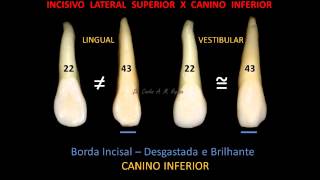 Anatomia Caninos [upl. by Ochs]