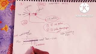 Brain herniation part 1kernohans notch phenomenonuncal herniation [upl. by Fiona]