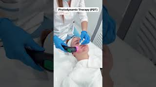 Revolutionary Acne Treatment in Dubai Photodynamic Therapy PDT at EDEN AESTHETICS Clinic [upl. by Heydon493]