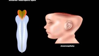 USMLE® Step 1 Neuroscience Development of CNS Animation [upl. by Melda]