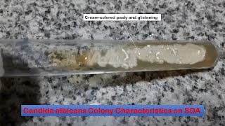 Candida colony characteristics on Sabouraud dextrose agar [upl. by Otreblada]