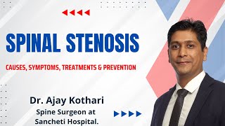 Spinal Stenosis Explained Causes Symptoms Treatments amp Prevention  Dr Ajay Kothari [upl. by Don39]