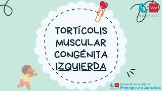 Tortícolis muscular congénita izquierda [upl. by Odanref]