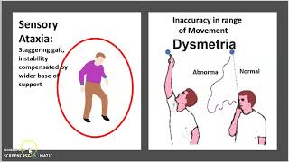 Friedreich’s ataxia Causes Symptoms Diagnosis Treatment Pathology USMLE NCLEX MCAT 3 minutes [upl. by Leena258]