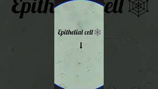 epithelial cells in urine normal range hpfepithelial cells positive in urineepithelial cells ky [upl. by Vasilis]