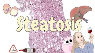 Steatosis  liver pathology [upl. by Anerbas]