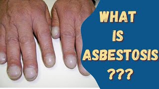 Asbestosis Asbestos disease Sign amp Symptoms Causes and risks [upl. by Aneis]