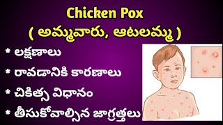 Chicken Pox  అమ్మ వారు ఆటలమ్మ  causes Symptoms and Treatment in Telugu [upl. by Noah]