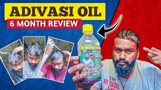 Adivasi hair oil 6 month review finally review💯 क्या हमें लेना चाहिए या नहीं [upl. by Dilahk442]