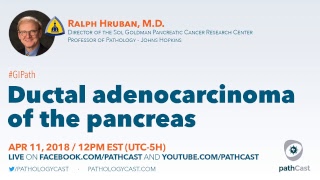 Ductal adenocarcinoma of the pancreas  Dr Hruban Hopkins GIPATH [upl. by Cherian]