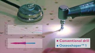 Nobel Biocare N1™ System Conventional drill compared to OsseoShaper™ GMT82637 [upl. by Eirdua]