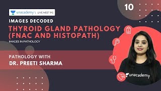 Images Decoded  Ep 10  Thyroid Gland Pathology FNAC and HISTOPATH  Dr Preeti Sharma [upl. by Diarmuid]