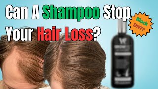 Does DHT Blocking Shampoos work  Best Shampoo for Hair Loss [upl. by Eigna]