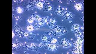 hepatocyte produced from human leukocytes via retrodifferentiation [upl. by Zach]