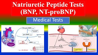 Natriuretic Peptide Tests BNP NT proBNP   What is   Uses  Need  Preparation  Results [upl. by Ardet747]